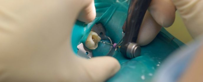 endodontie