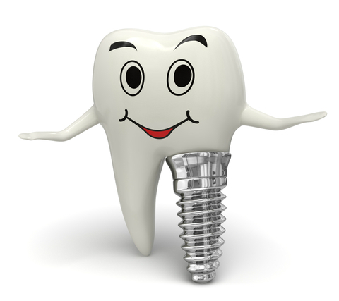 implant-dentaire-prix